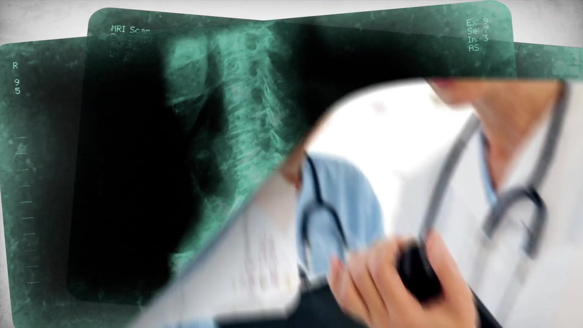 X Ray Medical Pack v2 Videohive 11515778 After Effects Image 8