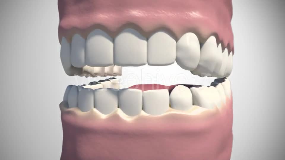 3D Dental Scaling Videohive 18397847 Motion Graphics Image 1