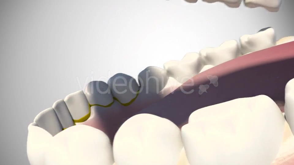 3D Dental Scaling Videohive 18397847 Motion Graphics Image 2