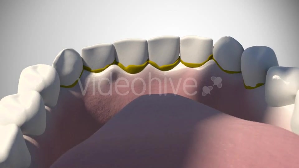 3D Dental Scaling Videohive 18397847 Motion Graphics Image 3