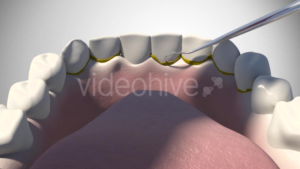 3D Dental Scaling Videohive 18397847 Motion Graphics Image 7