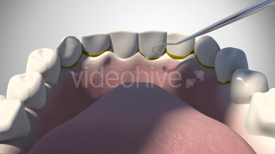 3D Dental Scaling Videohive 18397847 Motion Graphics Image 8