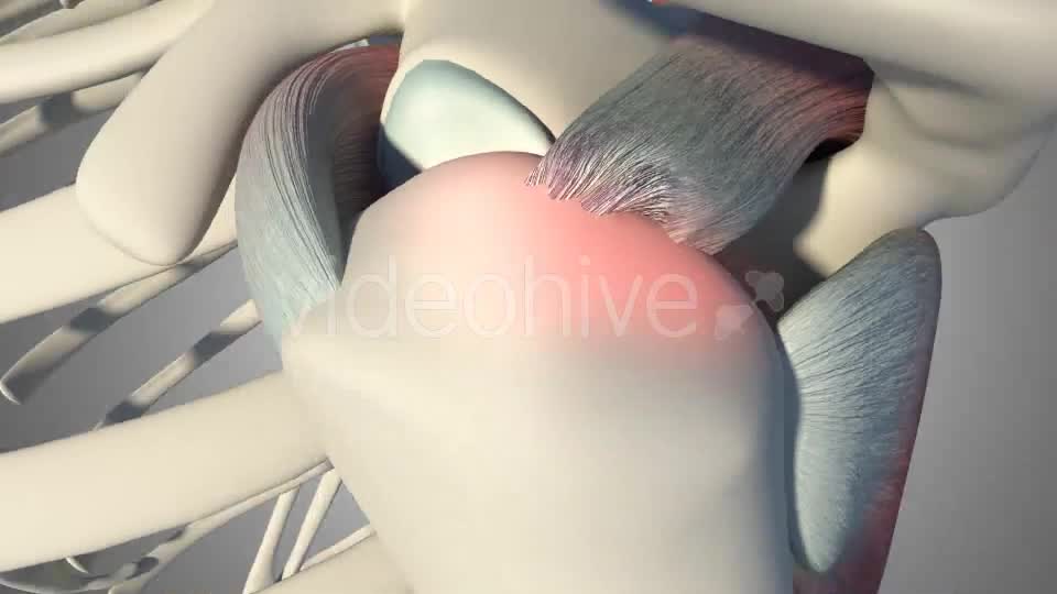 3D Rotator Cuff Tear Videohive 20511731 Motion Graphics Image 12
