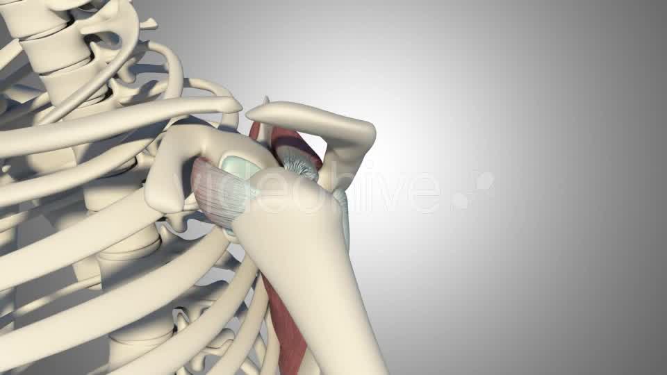 3D Rotator Cuff Tear Videohive 20511731 Motion Graphics Image 13