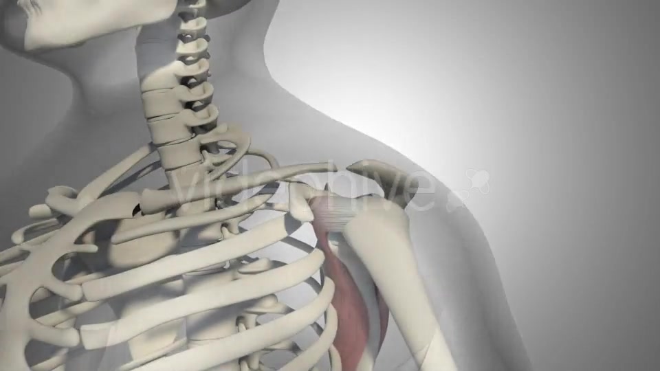 3D Rotator Cuff Tear Videohive 20511731 Motion Graphics Image 3