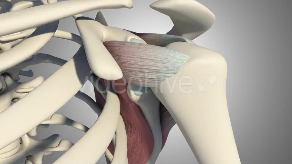 3D Rotator Cuff Tear Videohive 20511731 Motion Graphics Image 4