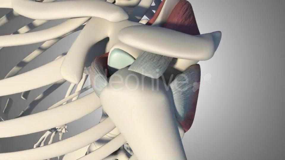 3D Rotator Cuff Tear Videohive 20511731 Motion Graphics Image 6