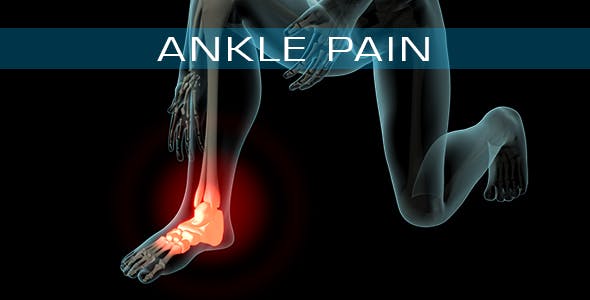 Ankle Pain - 21290882 Download Videohive