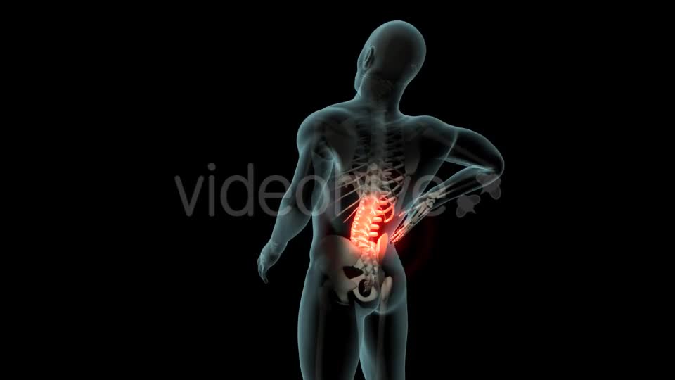 Back Pain Videohive 21254728 Motion Graphics Image 1