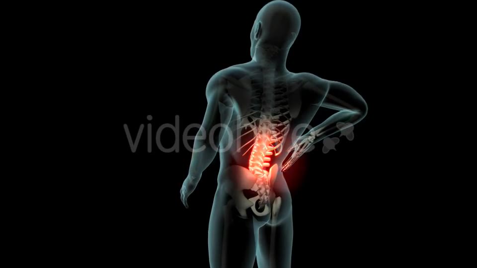 Back Pain Videohive 21254728 Motion Graphics Image 2
