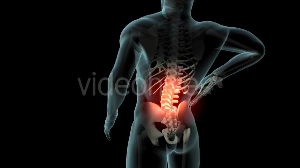 Back Pain Videohive 21254728 Motion Graphics Image 4