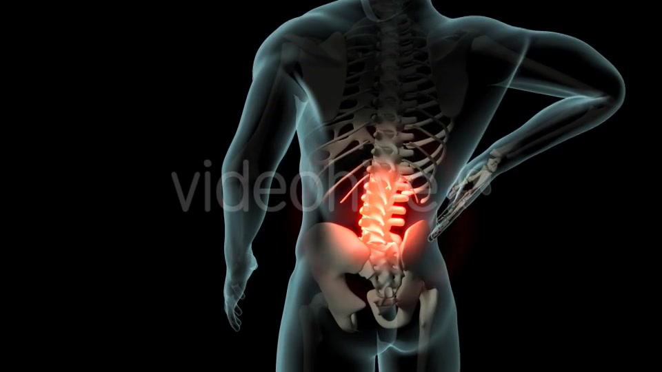 Back Pain Videohive 21254728 Motion Graphics Image 5