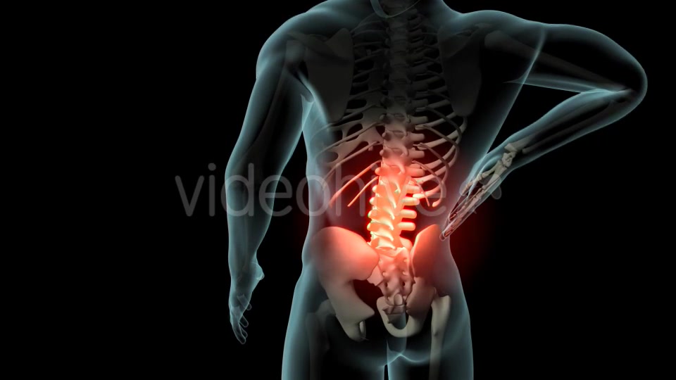 Back Pain Videohive 21254728 Motion Graphics Image 6