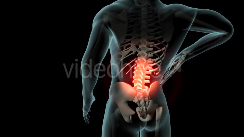 Back Pain Videohive 21254728 Motion Graphics Image 7