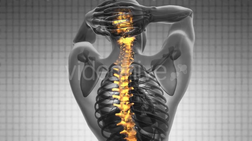 Backache in Back Bones Videohive 19403173 Motion Graphics Image 2