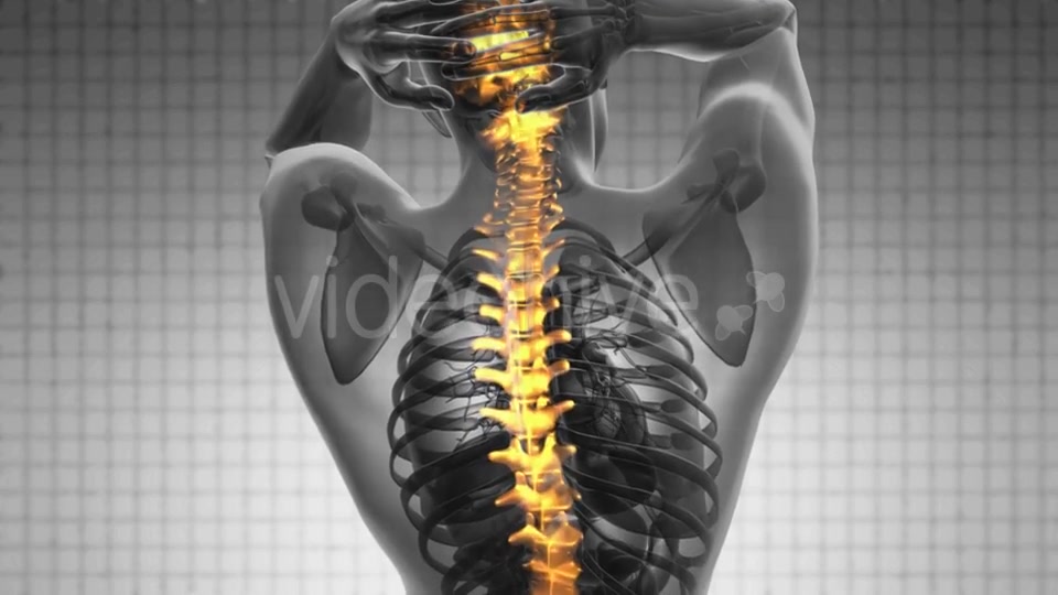 Backache in Back Bones Videohive 19403173 Motion Graphics Image 3