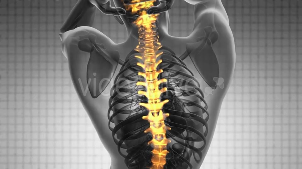 Backache in Back Bones Videohive 19403173 Motion Graphics Image 4