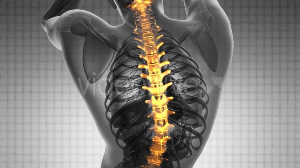 Backache in Back Bones Videohive 19403173 Motion Graphics Image 5