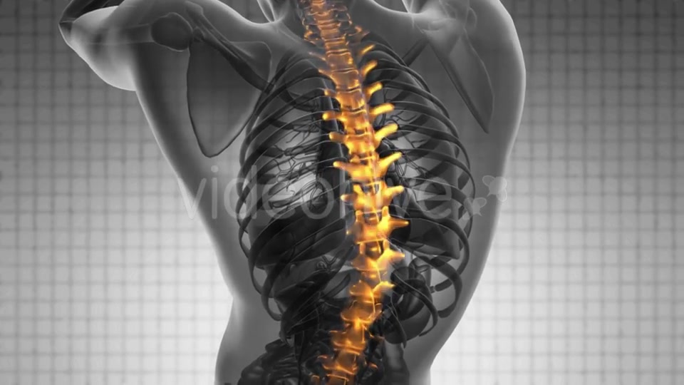 Backache in Back Bones Videohive 19403173 Motion Graphics Image 6