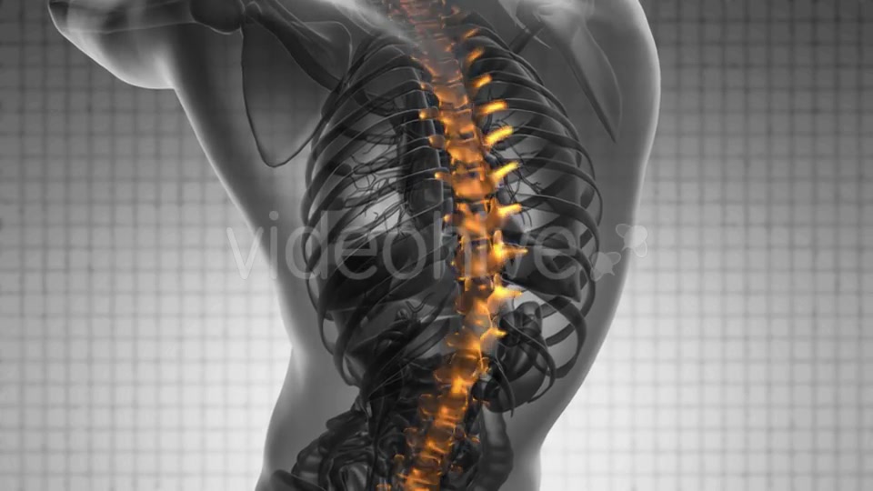 Backache in Back Bones Videohive 19403173 Motion Graphics Image 7