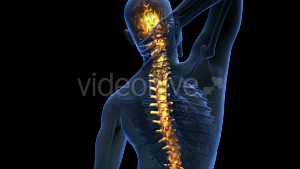 Backache in Back Bones Videohive 20011229 Motion Graphics Image 1