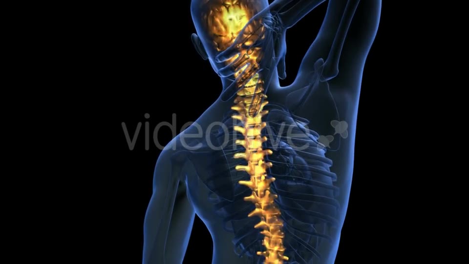 Backache in Back Bones Videohive 20011229 Motion Graphics Image 2