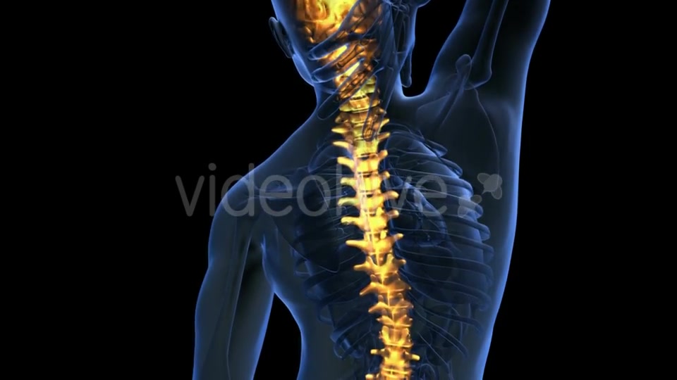 Backache in Back Bones Videohive 20011229 Motion Graphics Image 3