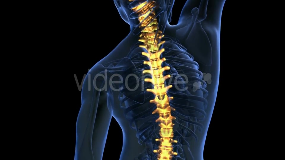 Backache in Back Bones Videohive 20011229 Motion Graphics Image 4