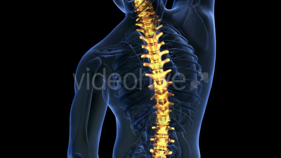 Backache in Back Bones Videohive 20011229 Motion Graphics Image 5