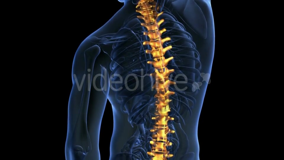 Backache in Back Bones Videohive 20011229 Motion Graphics Image 6