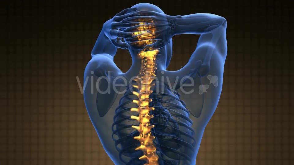 Backache in Back Bones Videohive 21264235 Motion Graphics Image 1
