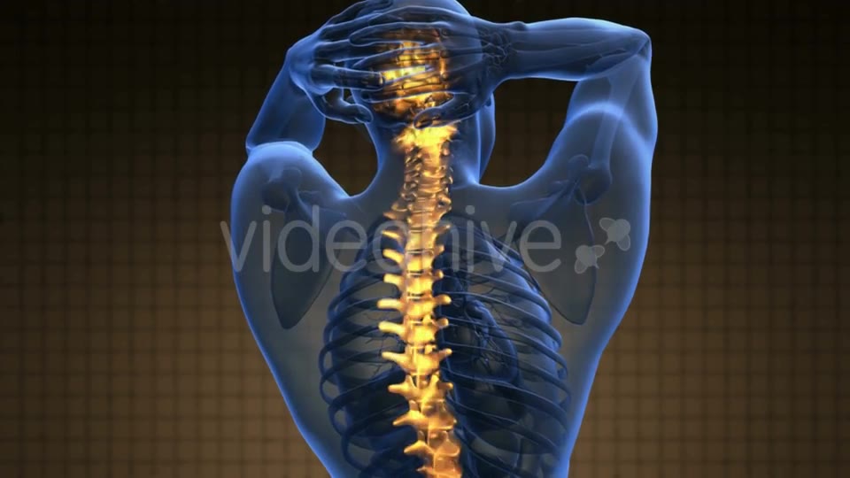 Backache in Back Bones Videohive 21264235 Motion Graphics Image 2