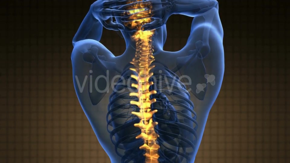 Backache in Back Bones Videohive 21264235 Motion Graphics Image 3