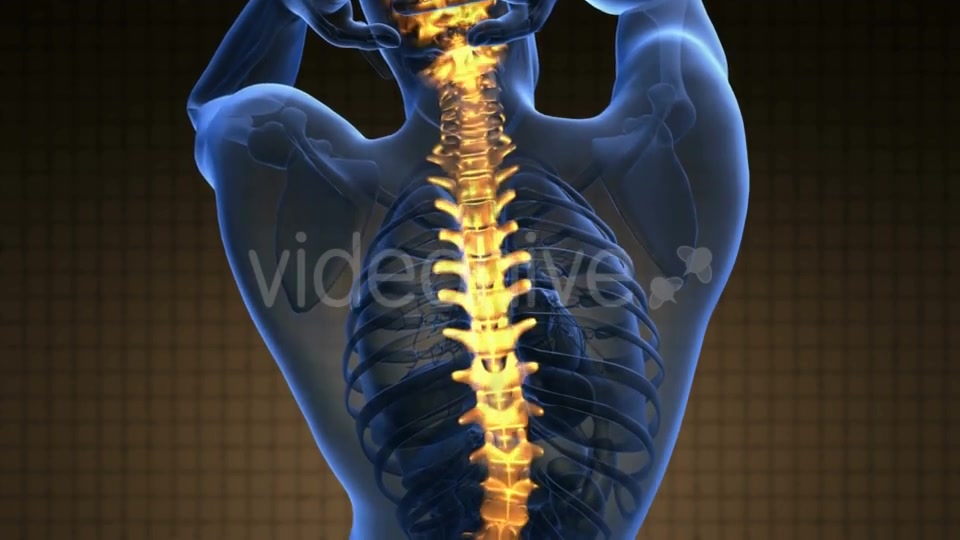 Backache in Back Bones Videohive 21264235 Motion Graphics Image 4