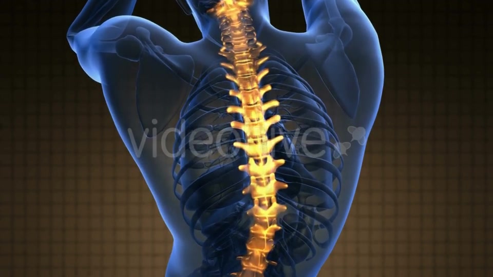 Backache in Back Bones Videohive 21264235 Motion Graphics Image 5