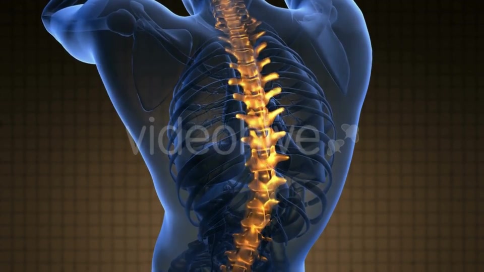 Backache in Back Bones Videohive 21264235 Motion Graphics Image 6