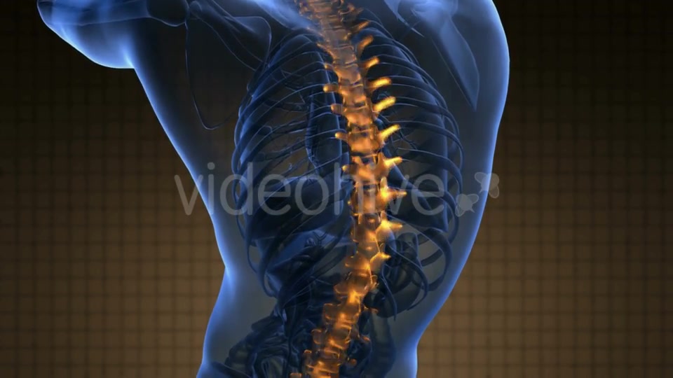 Backache in Back Bones Videohive 21264235 Motion Graphics Image 7