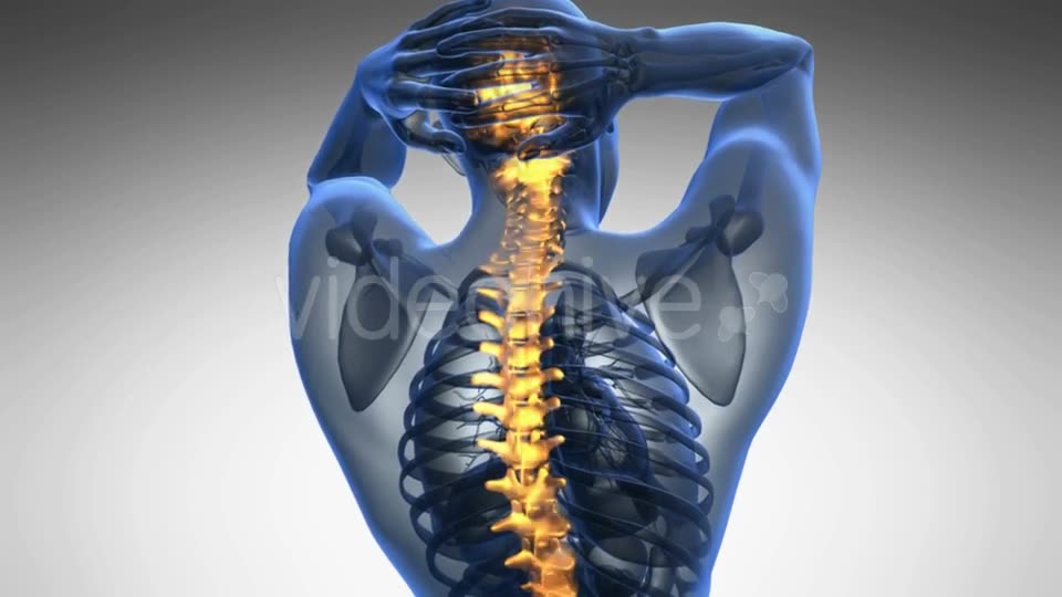Backache in Back Bones Videohive 19011781 Motion Graphics Image 2