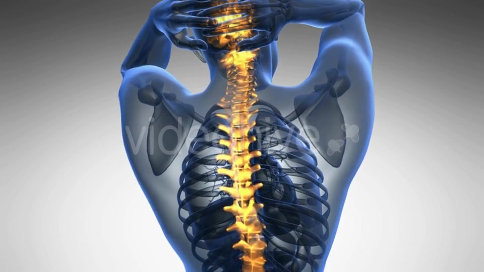 Backache in Back Bones Videohive 19011781 Motion Graphics Image 3