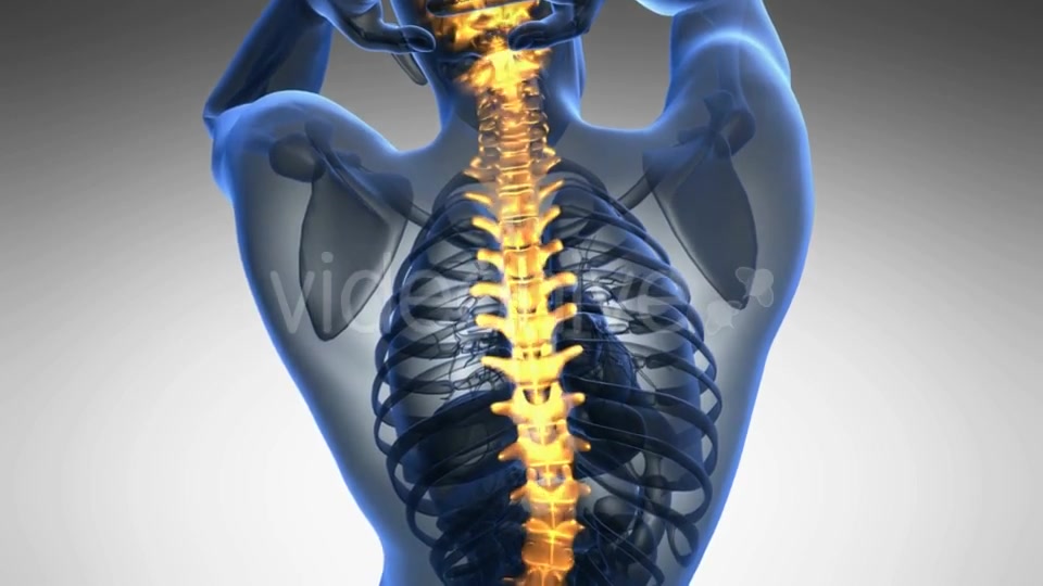 Backache in Back Bones Videohive 19011781 Motion Graphics Image 4