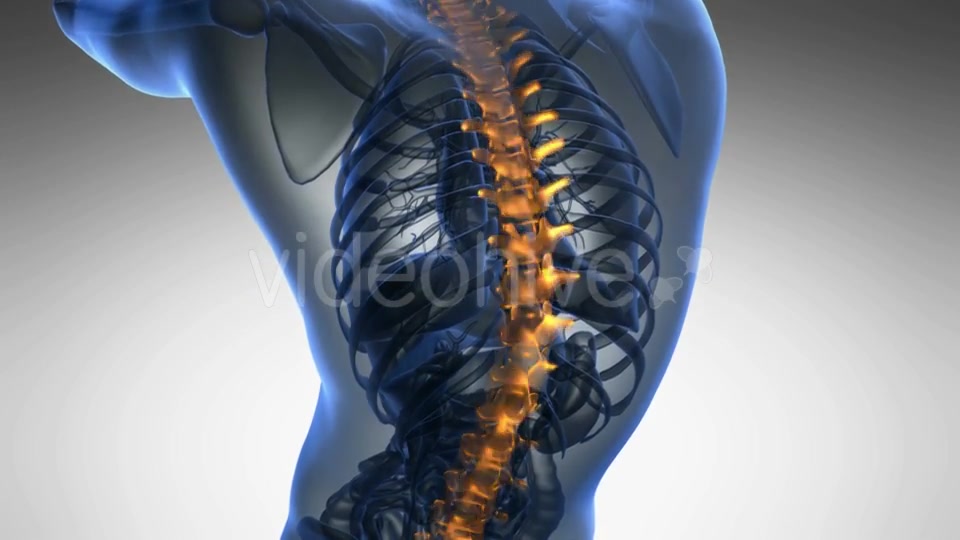 Backache in Back Bones Videohive 19011781 Motion Graphics Image 7