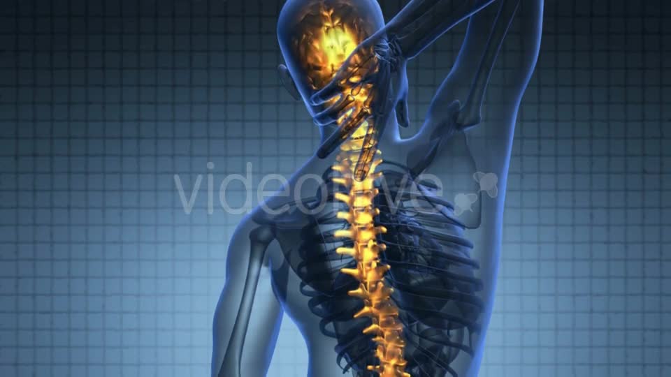 Backache in Back Bones Videohive 19893458 Motion Graphics Image 1