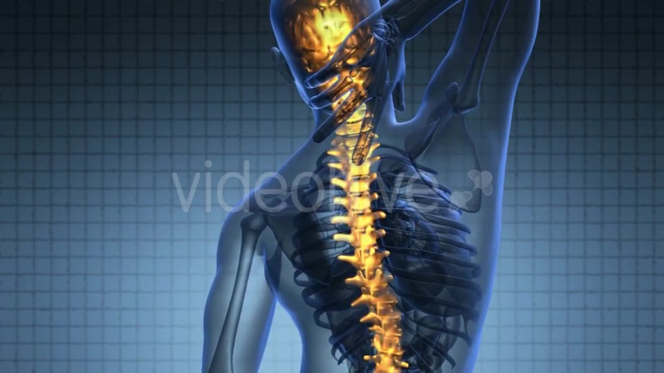 Backache in Back Bones Videohive 19893458 Motion Graphics Image 2
