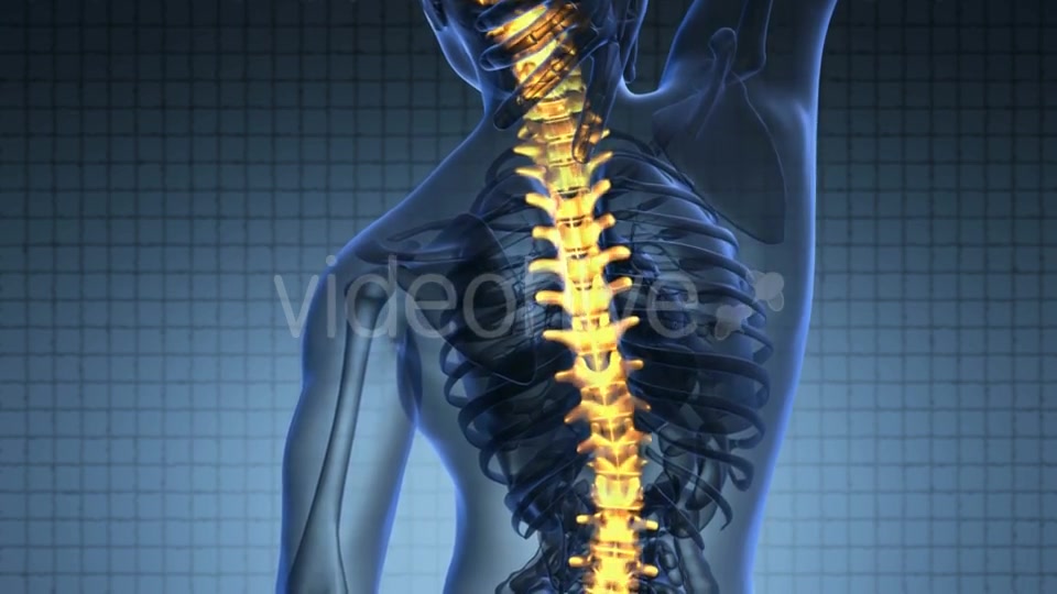 Backache in Back Bones Videohive 19893458 Motion Graphics Image 4
