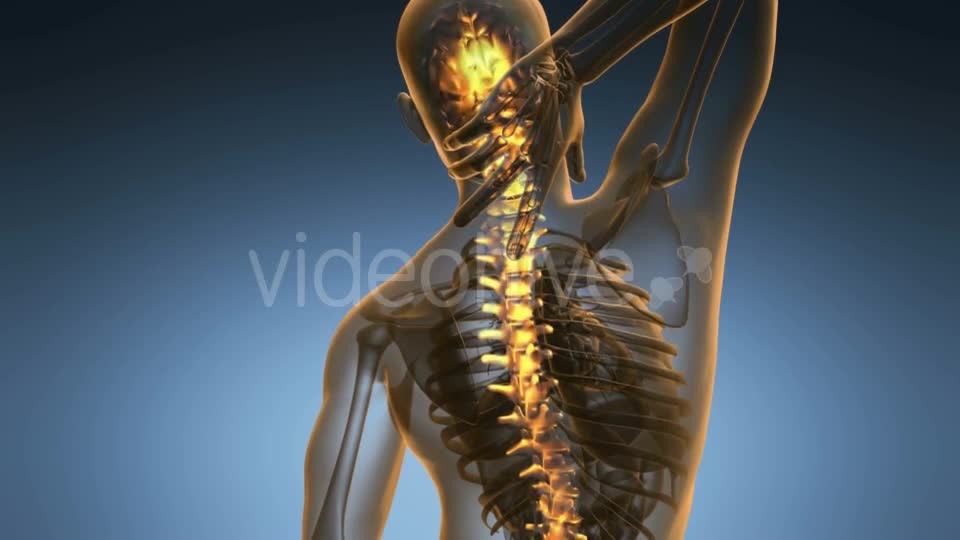 Backache in Back Bones Videohive 18967061 Motion Graphics Image 1