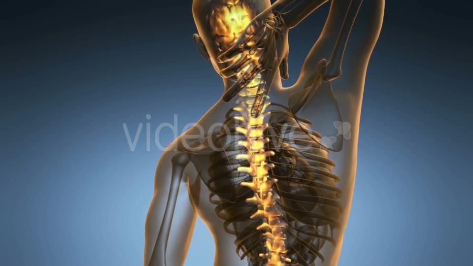 Backache in Back Bones Videohive 18967061 Motion Graphics Image 2
