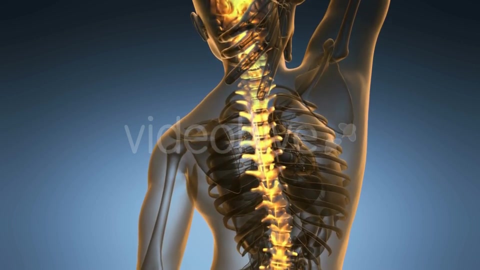Backache in Back Bones Videohive 18967061 Motion Graphics Image 3