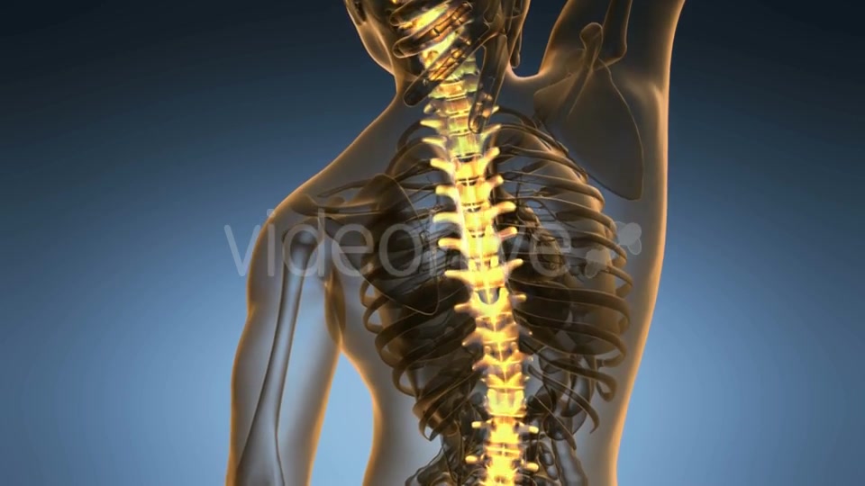 Backache in Back Bones Videohive 18967061 Motion Graphics Image 4
