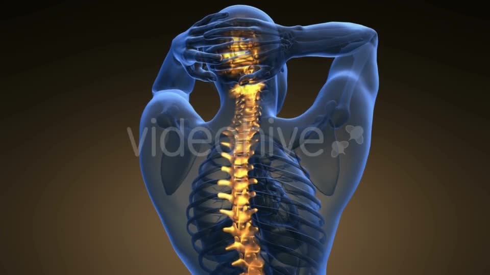 Backache In Back Bones Videohive 18535680 Motion Graphics Image 1