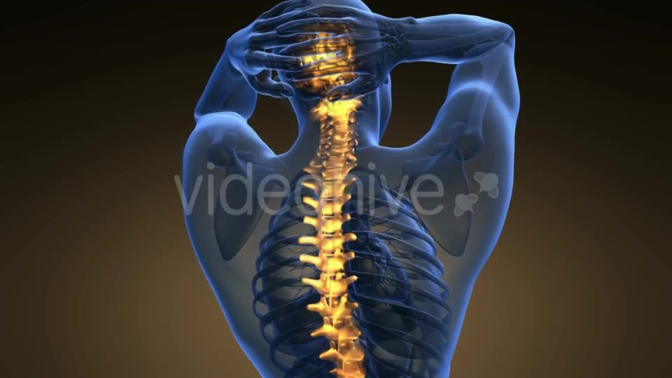 Backache In Back Bones Videohive 18535680 Motion Graphics Image 2